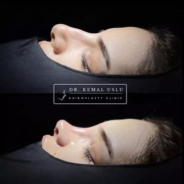 Slider image (3) Dr. Kemal Uslu Clinic